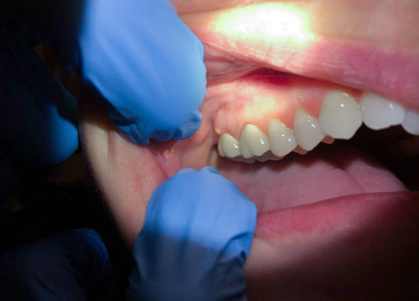 Best Weekend Emergency Dentist in Lovettsville, VA